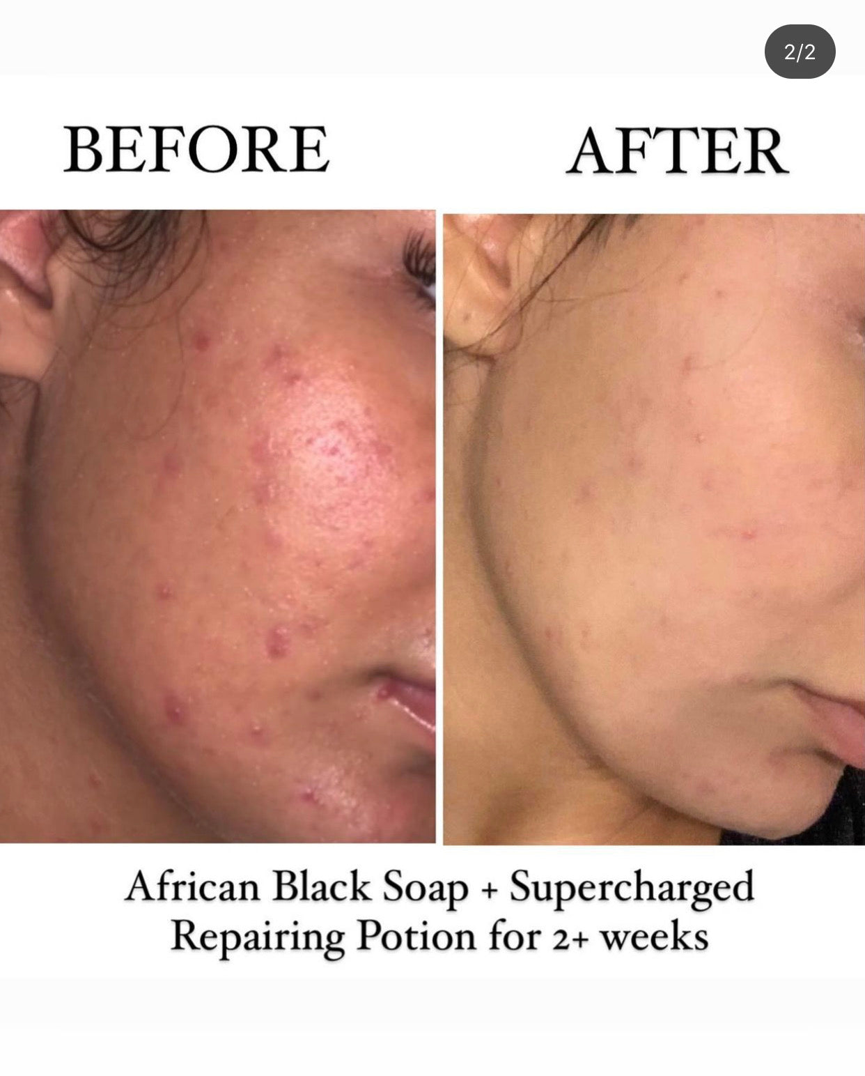 Supercharged Repairing Facial Potion